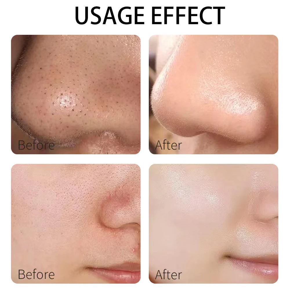 Ghassoul Clay Mask — Deep Cleanse & Purify